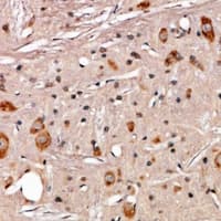 Polyclonal Rabbit anti-Human PABPC4 Antibody (IHC, WB)