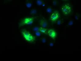 SQSTM1 Antibody (clone OTI6A7)