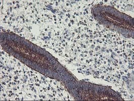 GOLM1 / GP73 / GOLPH2 Antibody (clone OTI4B12)