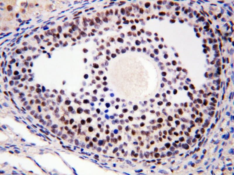 Polyclonal Rabbit anti-Human MTA1 Antibody (aa676-696, IHC, WB)