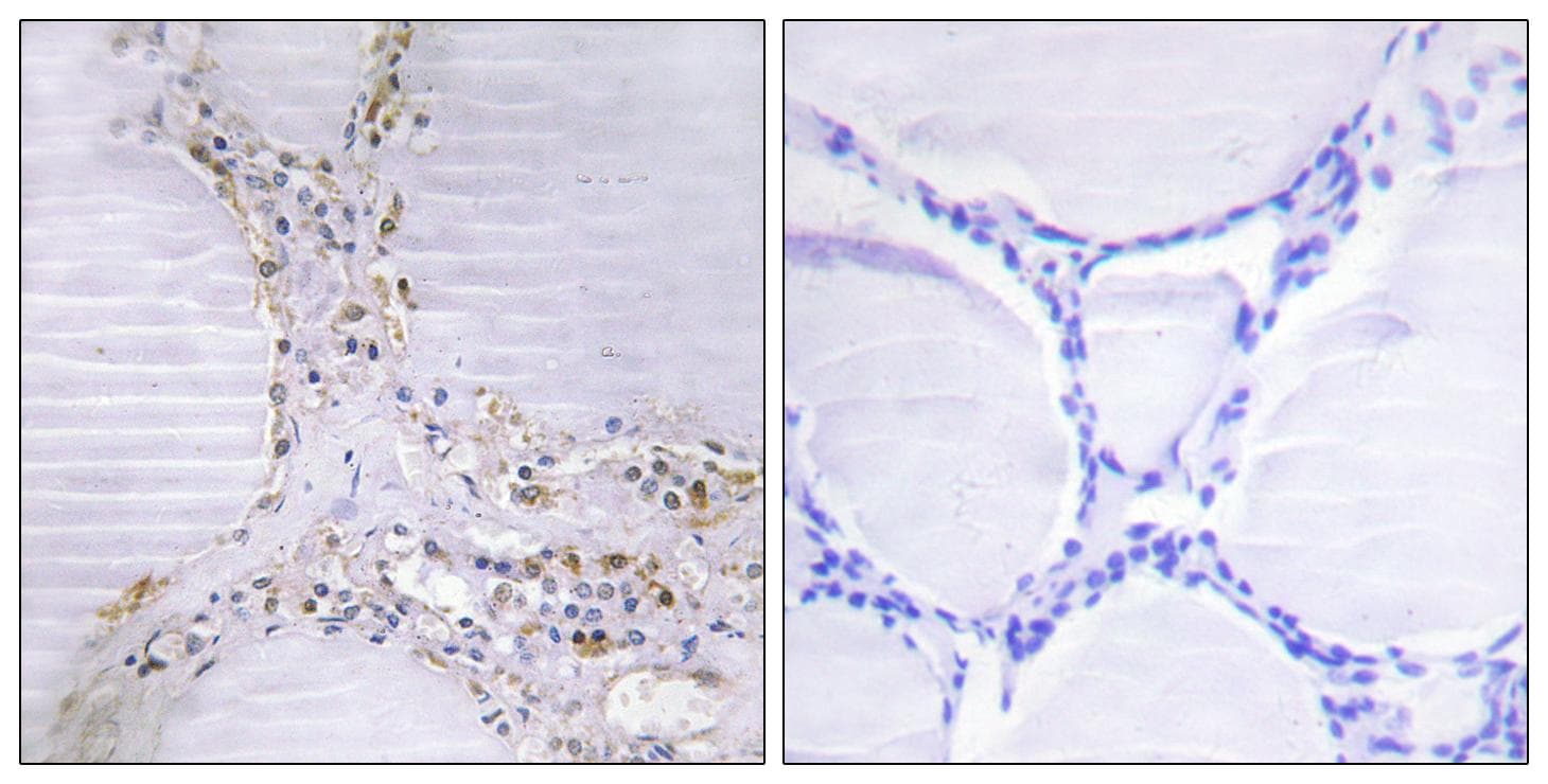 Polyclonal Rabbit anti-Human ETK / BMX Antibody (IHC, IF, WB)