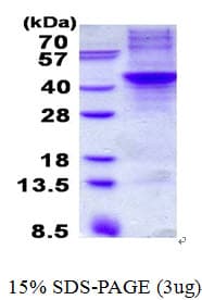Human APOH / Apolipoprotein H (Recombinant His)
