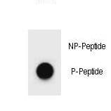 Polyclonal Rabbit anti-Human MAP1LC3A / LC3A Antibody (phospho-Ser12)