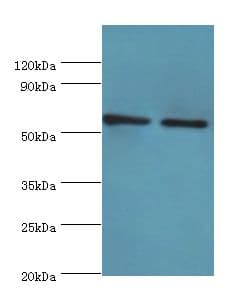 OXCT1 Antibody (aa261-520)