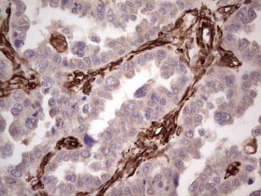 Peripherin Antibody (clone OTI1E10)
