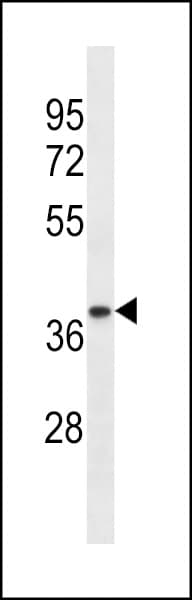 TRA2A Antibody (aa153-182)