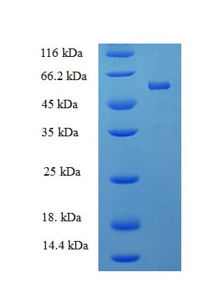 Human PTPRR Protein (Recombinant His-SUMO)