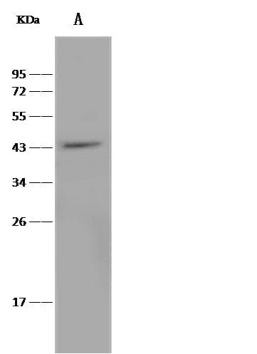 TRAIL-R4 / DCR2 Antibody (clone 201, Preservative Free)