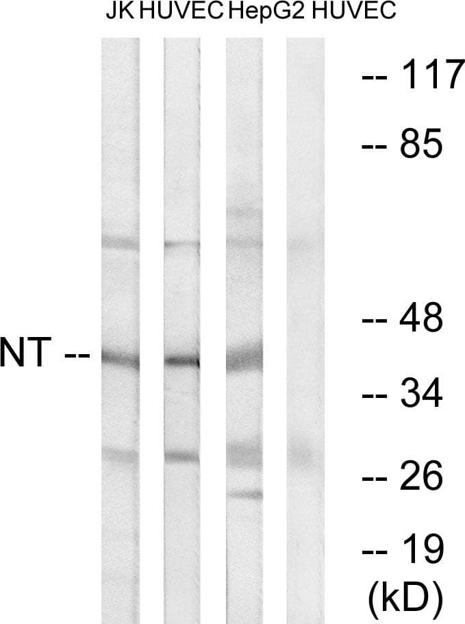 NTM / Neurotrimin Antibody
