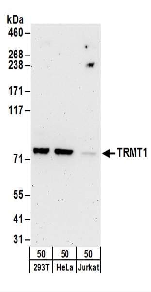 TRMT1 Antibody (aa609-659)