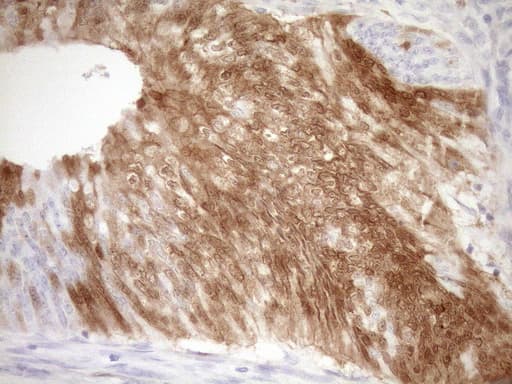 p16INK4a / CDKN2A Antibody (clone OTI3G3)