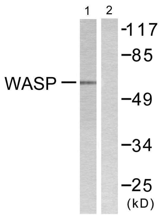 WAS / WASP Antibody (p290)