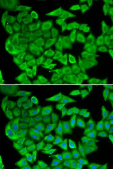 MDH / MDH2 Antibody