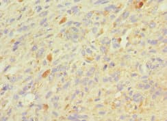Polyclonal Rabbit anti-Human GRN / Granulin Antibody (aa20-310, IHC)
