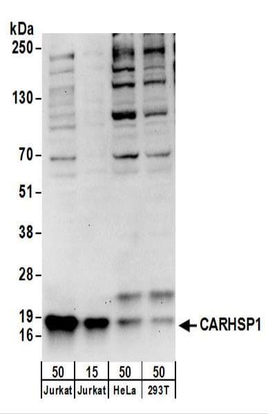 CARHSP1 Antibody (aa1-50)