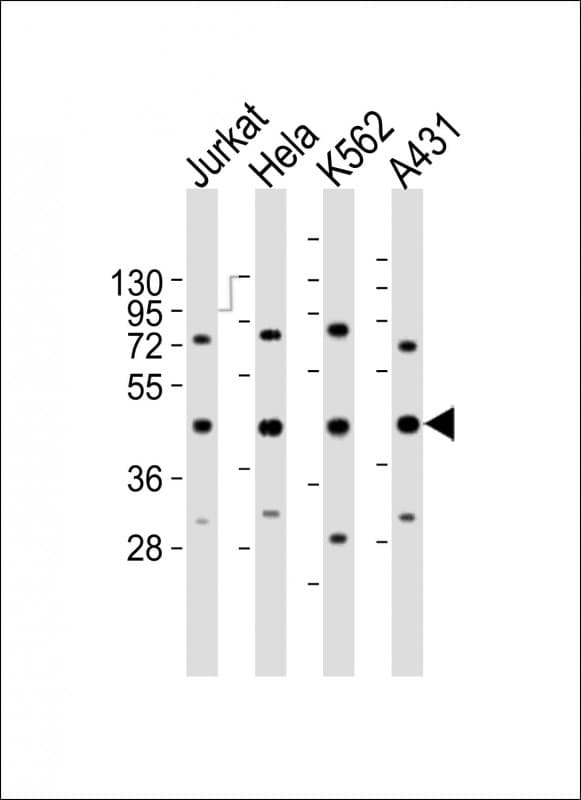 RBMX Antibody (aa222-252)