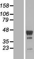 PHF6 Protein (Over-Expression Lysate Myc-DDK (Flag))