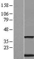 TMEM59 Protein (Over-Expression Lysate Myc-DDK (Flag))