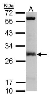 IDI1 / IPP1 Antibody (aa1-173)