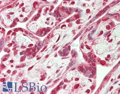 IHC-plus™ NMT1 Antibody (aa50-100)