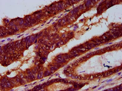LARP7 Antibody