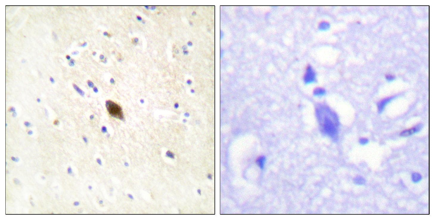 PRKDC / DNA-PKcs Antibody (phospho-Ser2612)