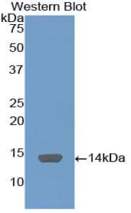 C4BPA / C4BP Alpha Antibody (aa358-469, PE)