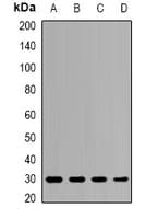 Polyclonal Rabbit anti-Human PSMB8 / LMP7 Antibody (IHC, IF, WB)