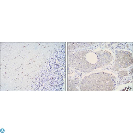 ALDH1A1 / ALDH1 Antibody