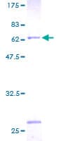 Human ATP6V0D1 Protein (Recombinant GST)