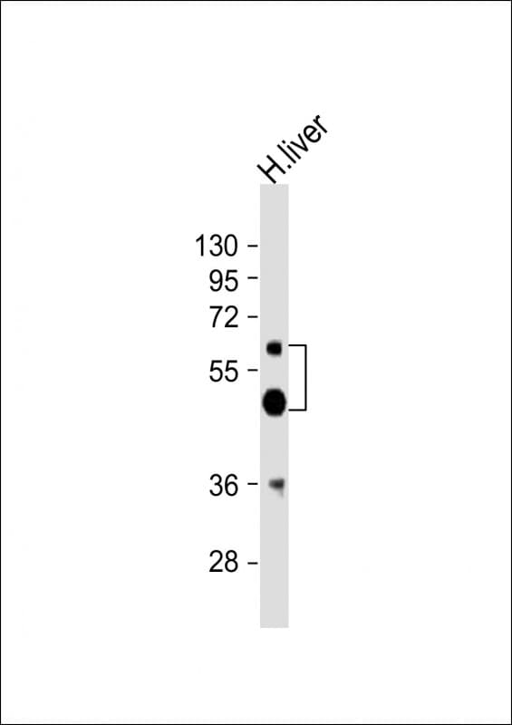 Polyclonal Rabbit anti-Human UGT2B4 Antibody (aa338-370, WB)