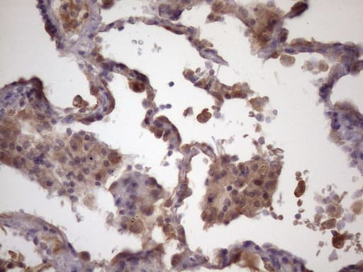 FOXO4 / AFX1 Antibody (aa206-505, clone OTI1A4)