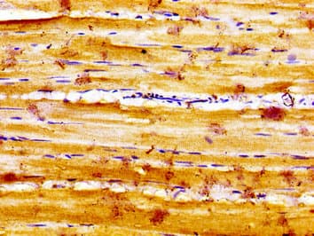 Polyclonal Rabbit anti-Human SLC16A12 / MCT12 Antibody (IHC, WB)