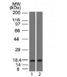 PIP / GCDFP-15 Antibody (clone PIP/1571)
