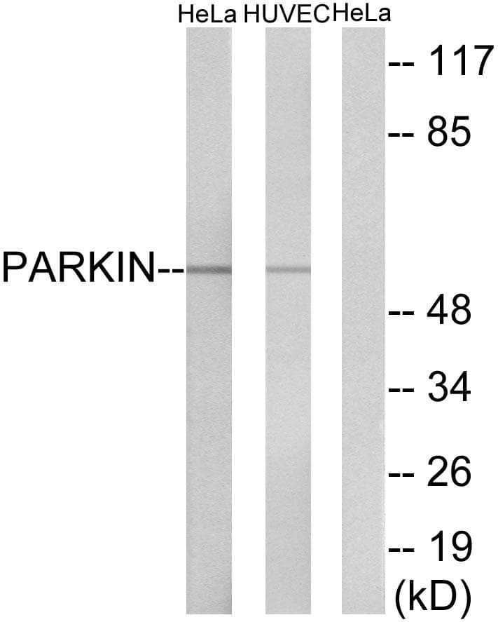 Polyclonal Rabbit anti-Human PARK2 / Parkin 2 Antibody (p131, IHC, WB)