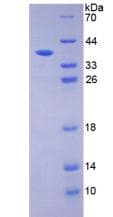 Mouse HDC / Histidine Decarboxylase Protein (Recombinant His-S)