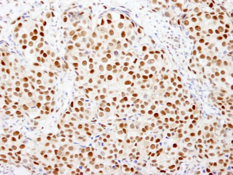 FKBP5 / FKBP51 Antibody (aa407-457)