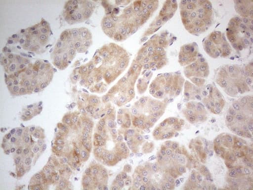 PDIA6 / ERP5 Antibody (clone OTI2H3)