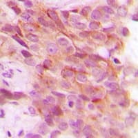 PSMD12 / Rpn5 Antibody (Internal)