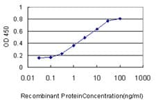 ACYP1 Antibody (clone 1B2-3A2)