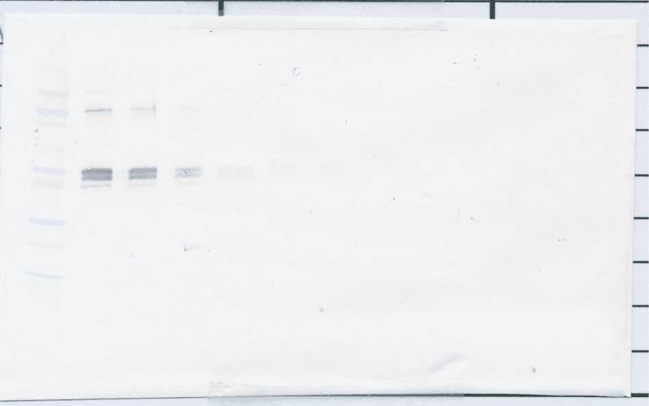 Polyclonal Rabbit anti-Human sCD14 Antibody (WB)