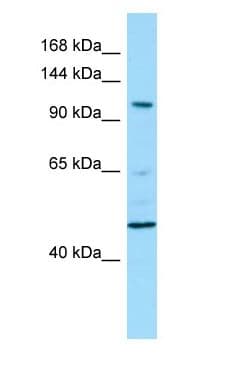 Polyclonal Rabbit anti-Human PDE11A Antibody (aa114-163, WB)