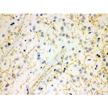 SLC6A4 / SERT Antibody (aa57-85)