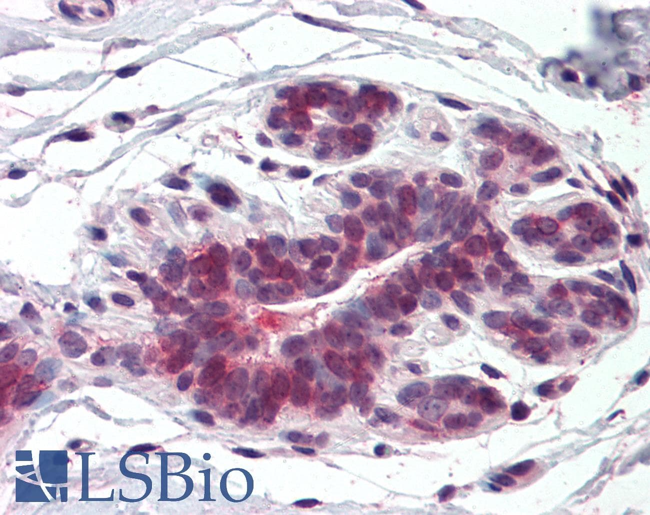 IHC-plus™ Polyclonal Rabbit anti-Human HELO1 / ELOVL5 Antibody (Internal, IHC)