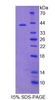 Human PRH2 Protein (Recombinant His-GST)