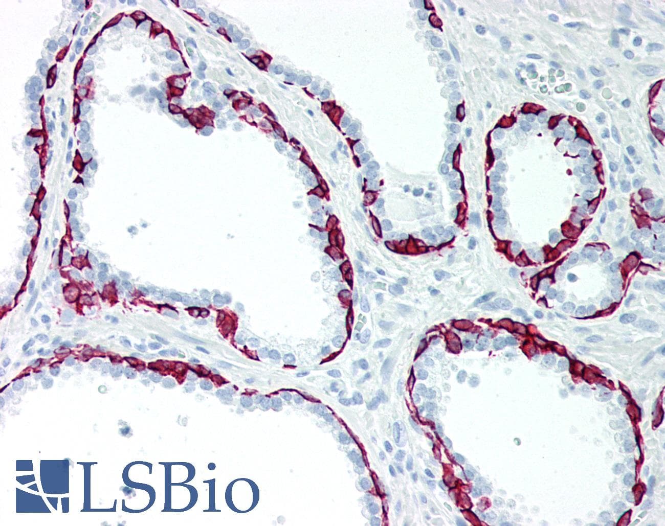PathPlus™ Monoclonal Mouse anti-Human KRT15 / CK15 / Cytokeratin 15 Antibody (IHC, WB)
