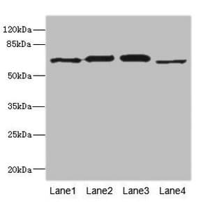 Polyclonal Rabbit anti-Human RPN2 / Ribophorin II Antibody (IHC, WB)