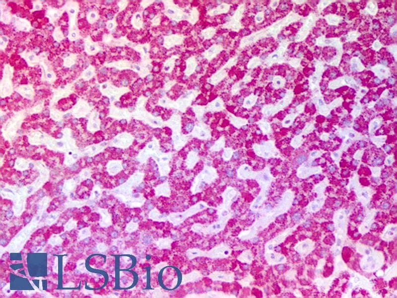 IHC-plus™ Polyclonal Rabbit anti-Human ASPM Antibody (Internal, IHC)