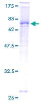 Human ZAP70 Protein (Recombinant GST)