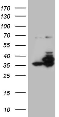 PPP4C Antibody (clone OTI2H8)